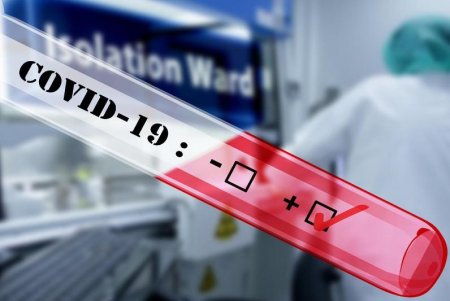 Қызылордада тағы 3 адам коронавирус инфекциясын жұқтырды