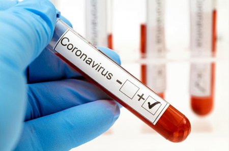 Қызылордада коронавирус инфекциясының 214 дерегі тіркелді