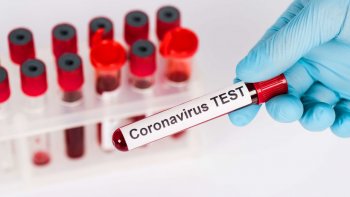 Қазақстанда коронавирус жұқтырғандар саны 4753 адамға жетті